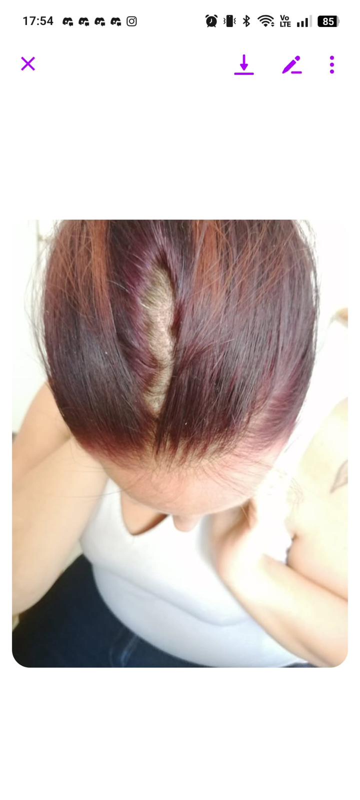 Avant traitement cheveux septembre